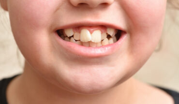 children’s oral health