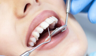 Cosmetic dentistry