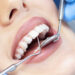 Cosmetic dentistry