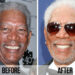 celebrity dental makeovers