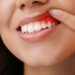 Gum Disease Impacts Overall Health