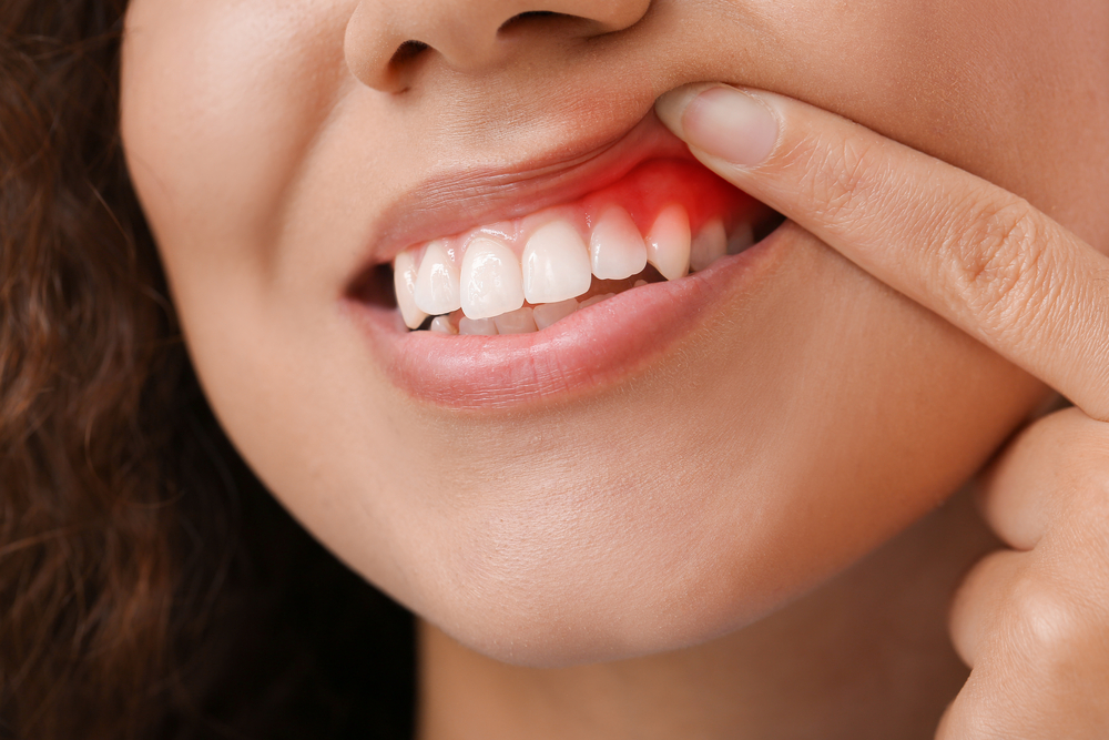 Gum Disease Impacts Overall Health