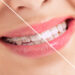 Cosmetic dentistry