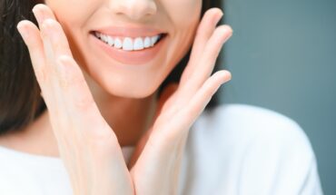 Teeth Whitening