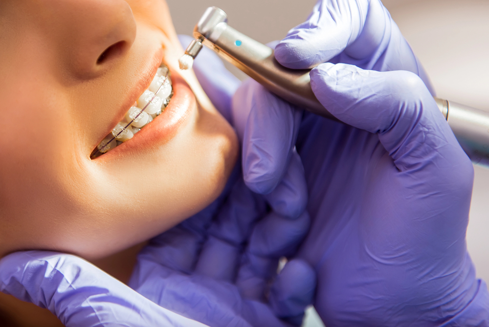 orthodontic dental tourism