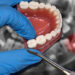 Dentures