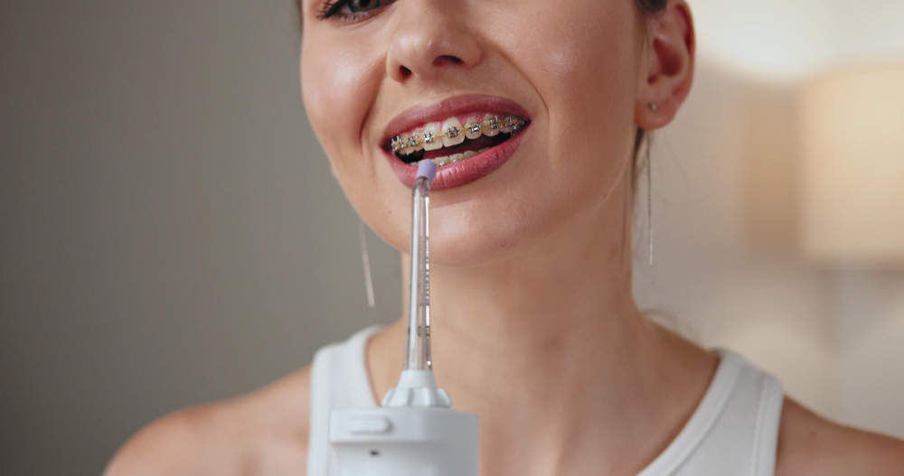 orthodontic solutions