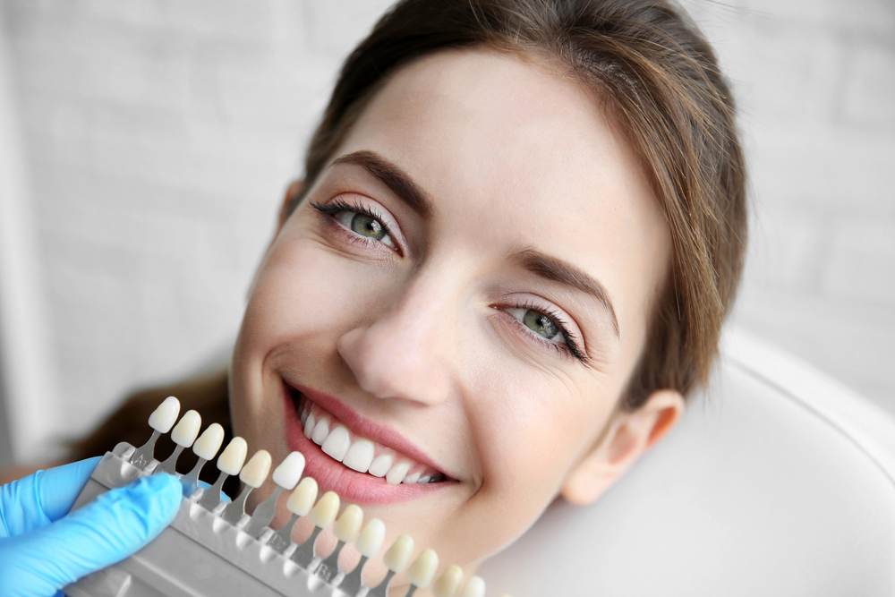 Porcelain veneers