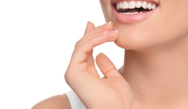 teeth whitening