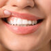 Healthy Gums