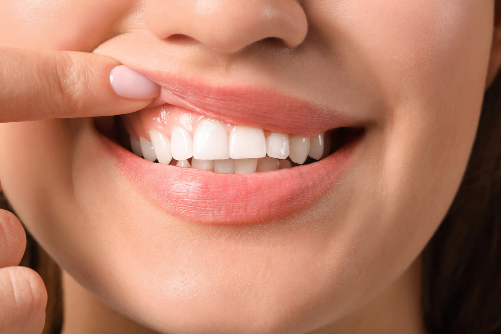 Healthy Gums