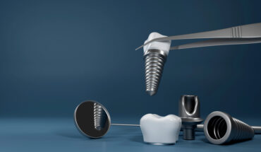 Modern dental implants