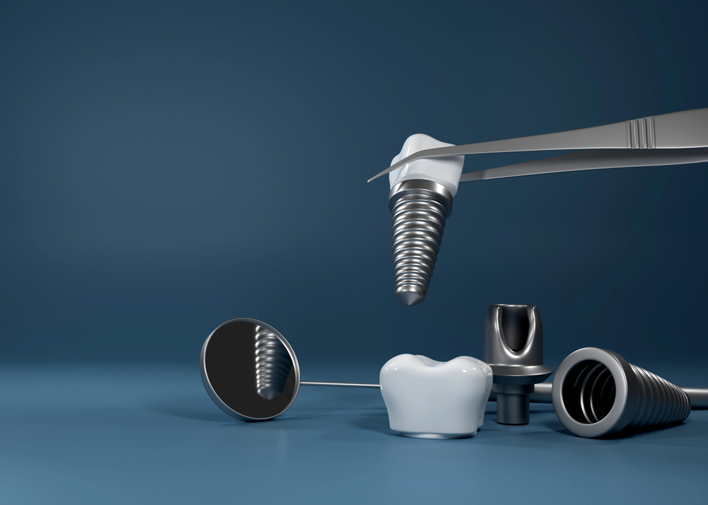 Modern dental implants